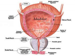 Bladder cancer